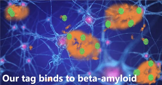 Alzheimers poster project